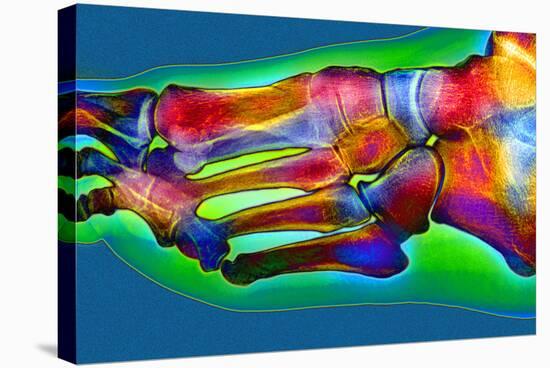 Normal Foot, X-ray-Du Cane Medical-Premier Image Canvas