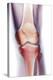 Normal Knee, X-ray-Du Cane Medical-Premier Image Canvas