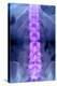 Normal Lumbar Spine, X-ray-Du Cane Medical-Premier Image Canvas