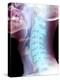 Normal Neck, X-ray-Du Cane Medical-Premier Image Canvas