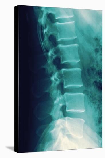 Normal Spine, X-ray-Miriam Maslo-Premier Image Canvas