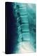 Normal Spine, X-ray-Miriam Maslo-Premier Image Canvas