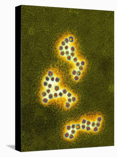 Norovirus Particles, TEM-Infections Centre-Premier Image Canvas