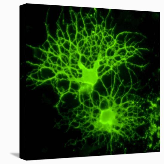 Oligodendrocyte Nerve Cells-Riccardo Cassiani-ingoni-Premier Image Canvas