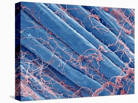 Optic Nerve Fibres, SEM-Steve Gschmeissner-Premier Image Canvas