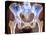 Osteoarthritis of Hip Joints, X-ray-Science Photo Library-Premier Image Canvas