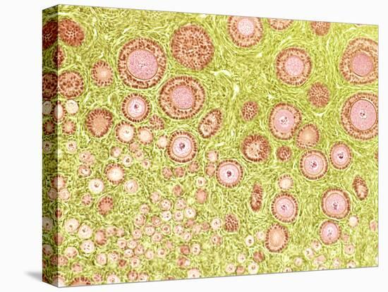 Ovarian Follicles, Light Micrograph-Steve Gschmeissner-Premier Image Canvas