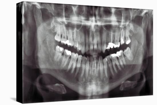 Panoramic Dental X-ray-null-Premier Image Canvas