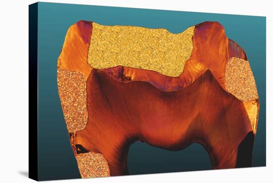 Polarised LM of a Tooth with Various Fillings-Volker Steger-Premier Image Canvas