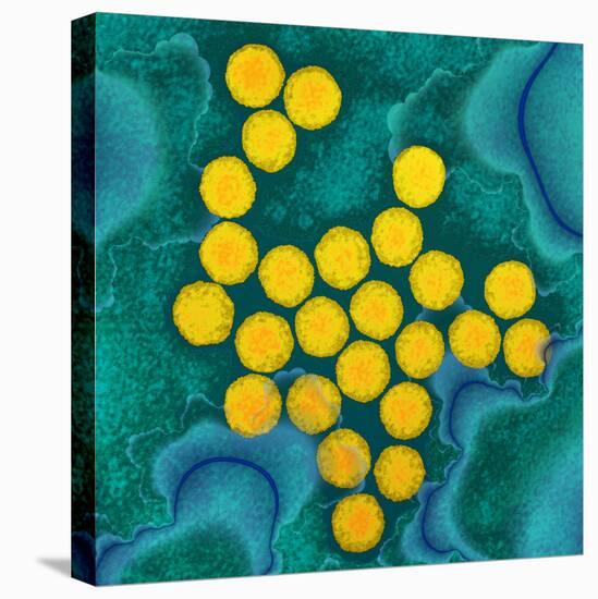 Polio Viruses, TEM-Dr. Linda Stannard-Premier Image Canvas