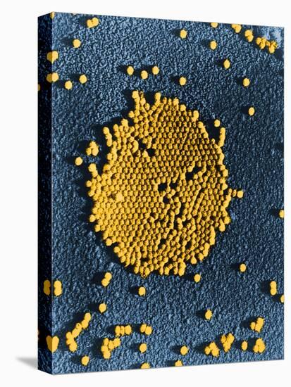 Poliovirus, TEM-Science Source-Premier Image Canvas