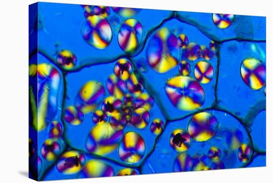 Potato Starch Grains, Light Micrograph-Dr. Keith Wheeler-Premier Image Canvas