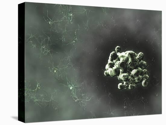 Prion Protein Plaque, Computer Artwork-Equinox Graphics-Premier Image Canvas