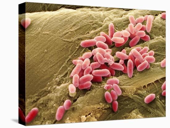 Pseudomonas Aeruginosa Bacteria, SEM-Steve Gschmeissner-Premier Image Canvas
