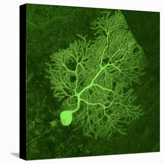 Purkinje Nerve Cell, Light Micrograph-Thomas Deerinck-Premier Image Canvas