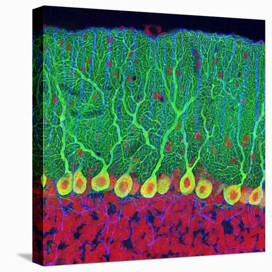 Purkinje Nerve Cells In the Cerebellum-Thomas Deerinck-Premier Image Canvas