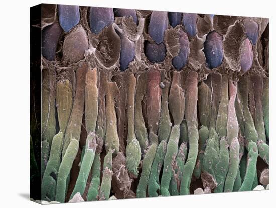 Retina Rod Cells, SEM-Science Photo Library-Premier Image Canvas