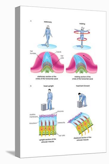 Root Canal Therapy. Dentistry, Endodontics, Teeth, Tooth Damage, Oral Health, Health and Disease-Encyclopaedia Britannica-Stretched Canvas