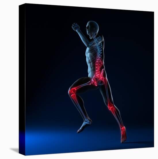 Running Injuries, Conceptual Artwork-SCIEPRO-Premier Image Canvas