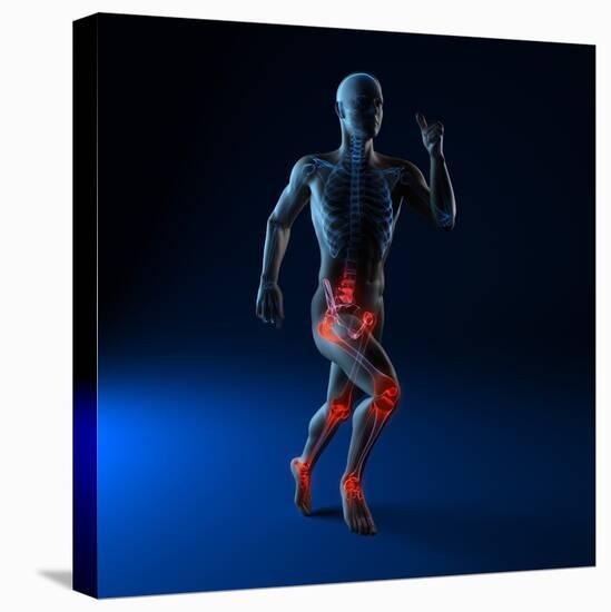 Running Injuries, Conceptual Artwork-SCIEPRO-Premier Image Canvas