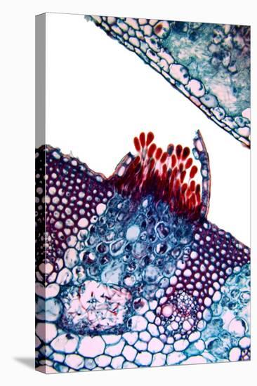 Rust Fungus In a Leaf, Light Micrograph-Dr. Keith Wheeler-Premier Image Canvas