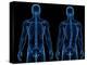 Scoliosis of the Spine, Artwork-SCIEPRO-Premier Image Canvas