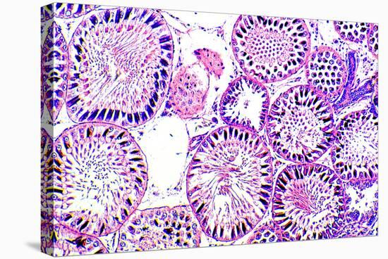 Seminiferous Tubules-Dr. Keith Wheeler-Premier Image Canvas