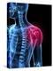 Shoulder Pain, Conceptual Artwork-SCIEPRO-Premier Image Canvas