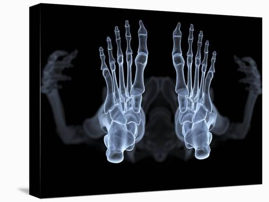 Skeleton From Below, X-ray Artwork-David Mack-Premier Image Canvas