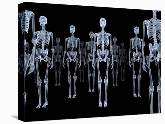 Skeletons, X-ray Artwork-David Mack-Premier Image Canvas