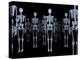 Skeletons, X-ray Artwork-David Mack-Premier Image Canvas