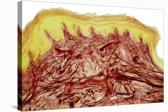 Skin Layers, Light Micrograph-Steve Gschmeissner-Premier Image Canvas