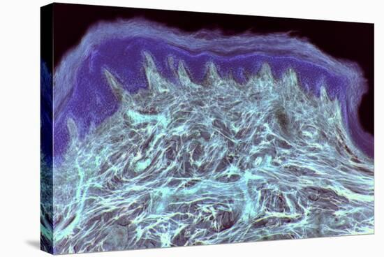Skin Layers, Light Micrograph-Steve Gschmeissner-Premier Image Canvas