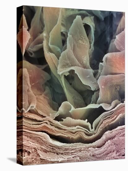 Skin Surface, SEM-Steve Gschmeissner-Premier Image Canvas