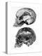Skull of Piltdown Man (Eanothropus Daswon), 1912-null-Premier Image Canvas