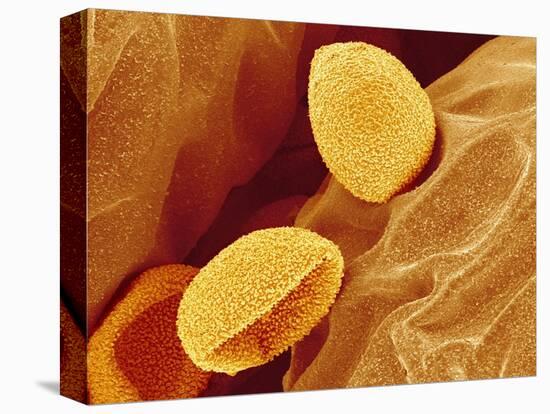 Spores of a Flowering Fern-Micro Discovery-Premier Image Canvas