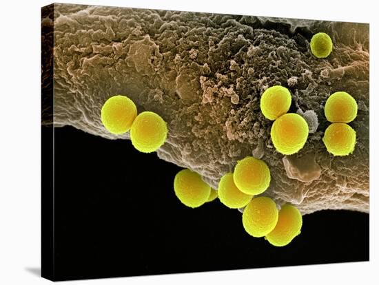 Staphylococcus Aureus Bacteria, SEM-Science Photo Library-Premier Image Canvas