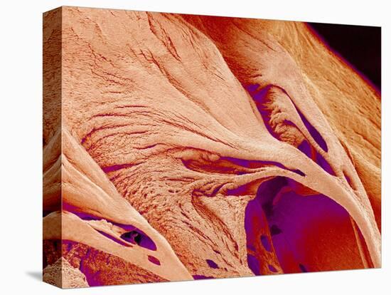 Surface of a valve of a rat heart-Micro Discovery-Premier Image Canvas