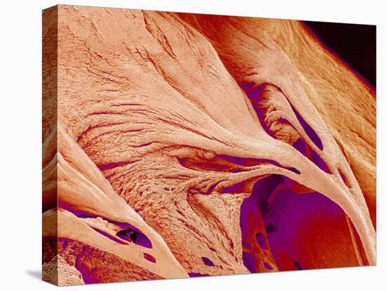 Surface of a valve of a rat heart-Micro Discovery-Premier Image Canvas