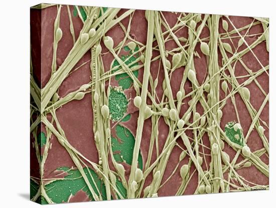 Synapse Nerve Junctions, SEM-Thomas Deerinck-Premier Image Canvas