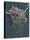 T Lymphocytes And Cancer Cell, SEM-Steve Gschmeissner-Premier Image Canvas