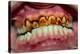 Teeth Showing Plaque-Science Photo Library-Premier Image Canvas