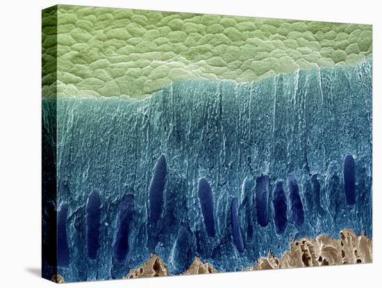 Tooth Enamel Formation, SEM-Steve Gschmeissner-Premier Image Canvas