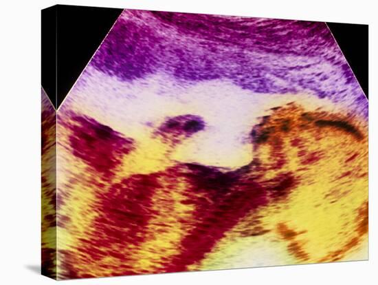 Ultrasound Scan of 20 Week Old Foetus (side View)-Science Photo Library-Premier Image Canvas