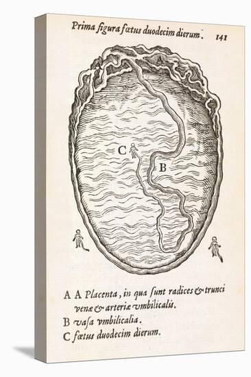 Uterus And Embryo, 16th Century-Middle Temple Library-Premier Image Canvas