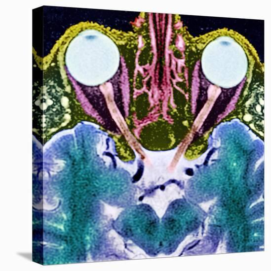 Vision And the Brain, MRI Scan-Science Photo Library-Premier Image Canvas