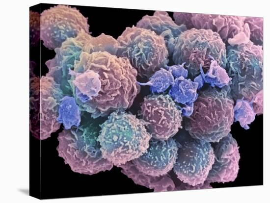 White Blood Cells And Platelets-Steve Gschmeissner-Premier Image Canvas