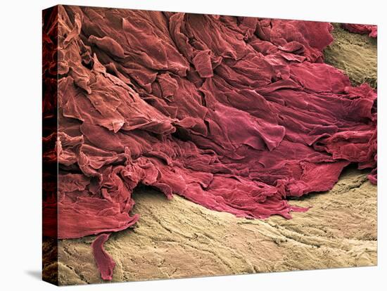 Wound Scab, SEM-Steve Gschmeissner-Premier Image Canvas