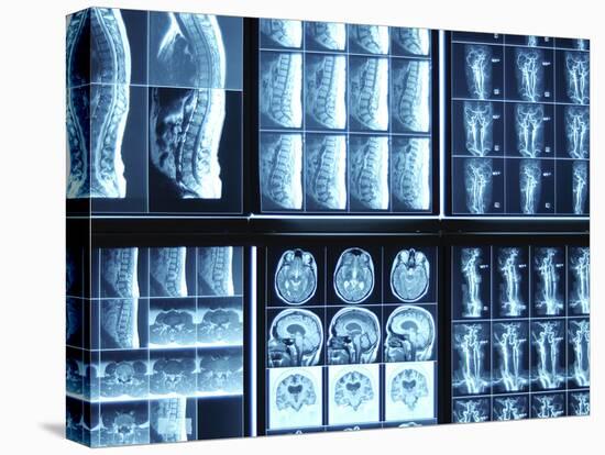 X-Ray Images on Computer Screen-null-Premier Image Canvas