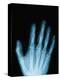 X-Ray of a Hand-Robert Llewellyn-Premier Image Canvas